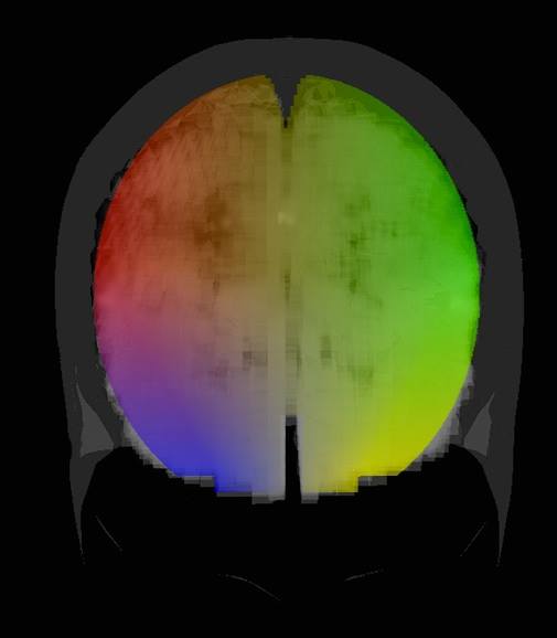 Brain image created using BrainMaster software BrainAvatar