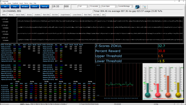 qeeg pro software