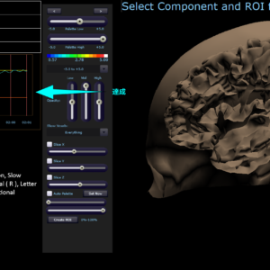 qEEG Pro software