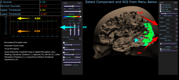 qEEG Pro software