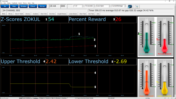 qeeg pro software