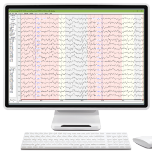 Stand-Alone ANI Products