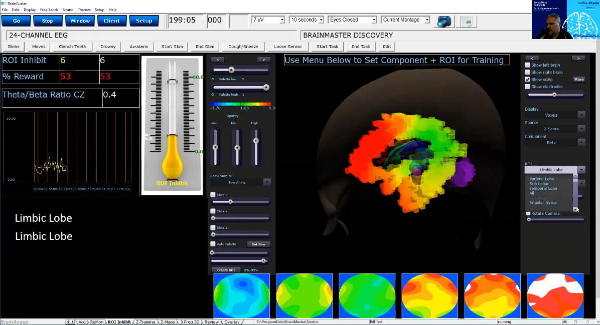 Z-Score Neurofeedback: Retrospect and Prospect- BrainMaster