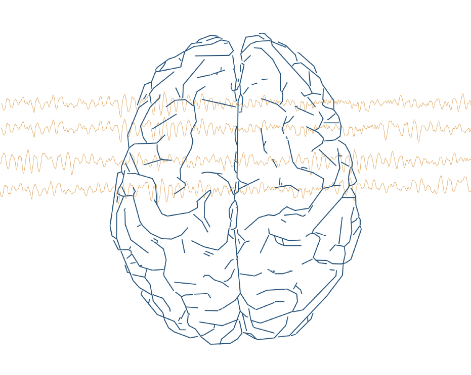 qEEG Report Brain Image